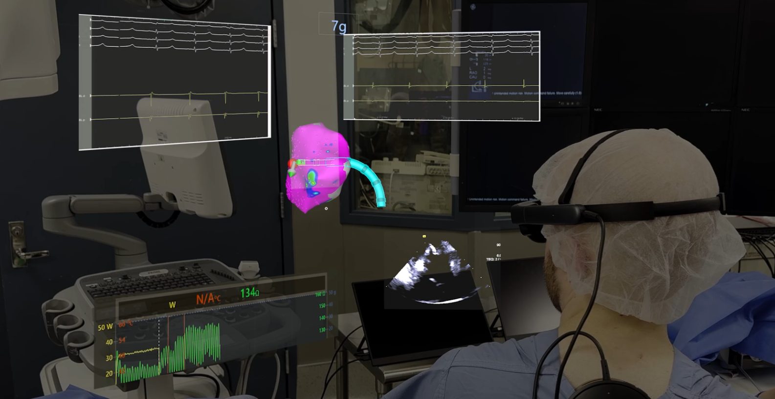CommandEP holographic visualization showing a live 3D cardiac map with catheter position, EGMs and fluoroscopy