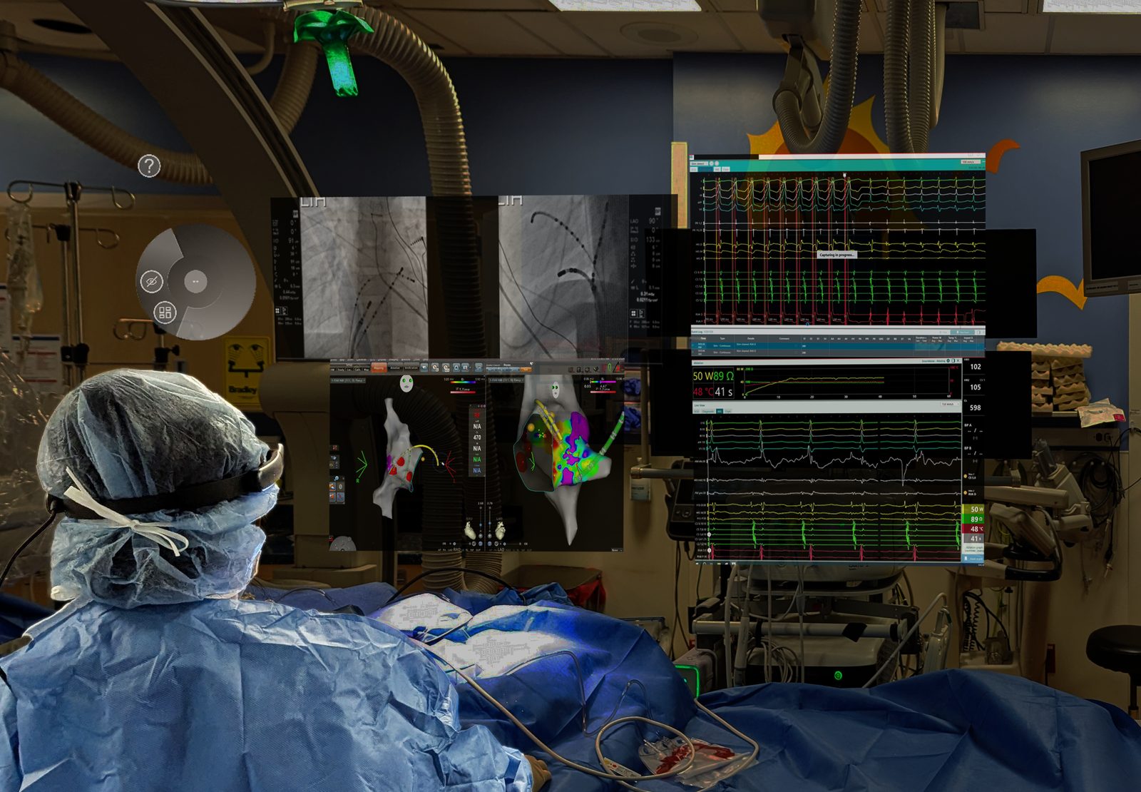 VistaMD virtual screen system showing fluoroscopy, EGM, ablation and 3D map displays through the headset
